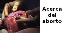 Ir al Micrositio Acerca del aborto